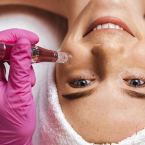 12 Days of Christmas: Day 1: SkinPen